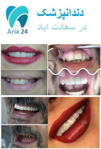 بهترین دندانپزشک در سعادت آباد | کلینیک دکتر سید محسنی | مشاوره رایگان : 02122366650